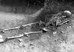 Skeletal remains