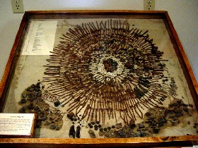 1,400 metal objects were removed from a patient at Glore Psychiatric Museum